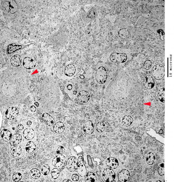 5A2 iPLA2beta WT Cerebellum (06-211A) nl Purkinje  & granule cells EM 34 copy - Copy