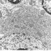 5A4 Normal Cerebellum Purkinje and granule cells iPLA2beta WT Cerebellum (06-211A) nl Purkinje cell EM 28 - Copy