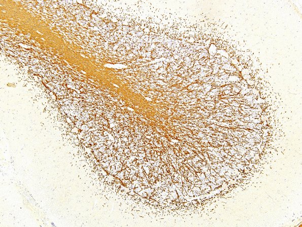 6A1 Normal Cerebellum, Myelin Basic Protein (UPenn Control Slide)  2