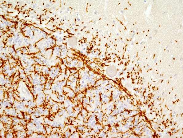 6A2 Normal Cerebellum, Myelin Basic Protein (UPenn Control Slide)  1