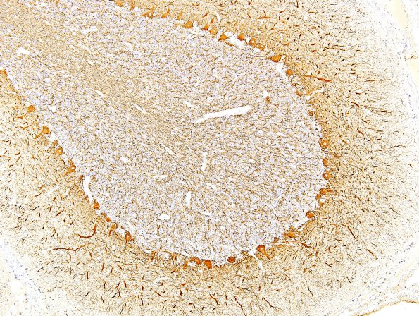 6B1 Normal Cerebellum, NF (UPenn Control Slide) 2