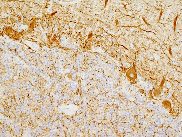 6B2 Normal Cerebellum, NF (UPenn Control Slide) 1