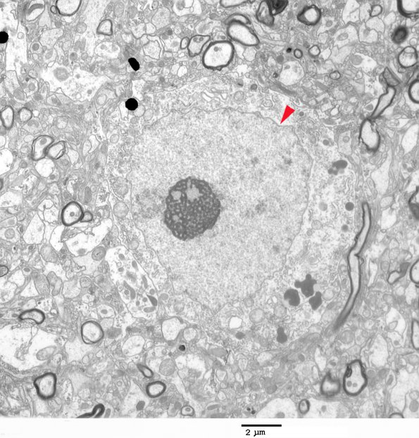 1A1 Normal Cerebral Cortex (Case 1) EM 128 copy - Copy