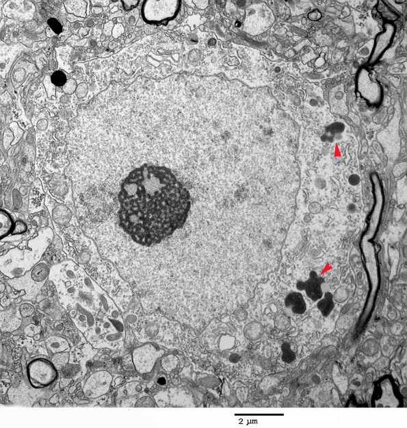 1A2 Normal Cerebral Cortex (Case 1) EM 120 copy - Copy