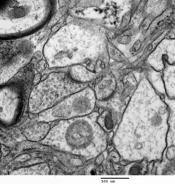 1A5 Normal Cerebral Cortex (Case 1) EM 131 - Copy