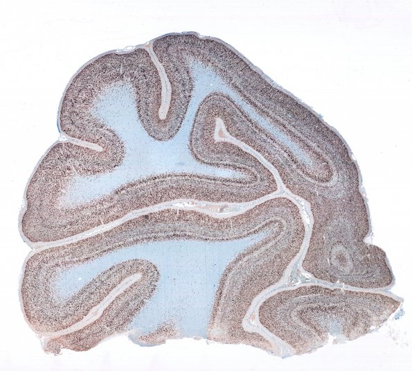 1 Normal, cortex (Case 1) NeuN 1a