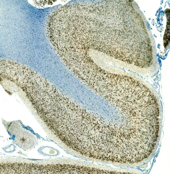 2A1 Cerebral Cortex, normal (Case 2) NeuN 2