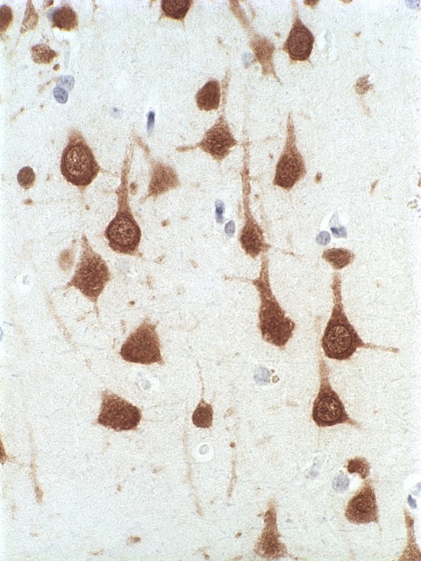 2A2 Cerebral Cortex, normal (Case 2) NeuN 3