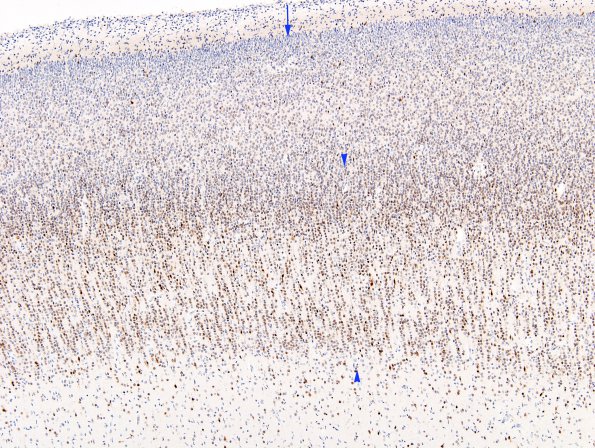 3A1 Cerebral Cortex, 26 wks (Case 3) NeuN 5 copy