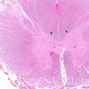 1A1 Clarke's Column Nucleus chromatolysis mimic (Case 1) H&E 6 copy