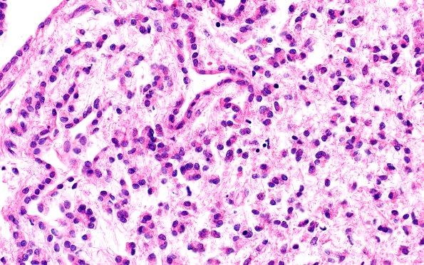 10A4 Ependyma, lateral ventricle (Case 10) N2 40X