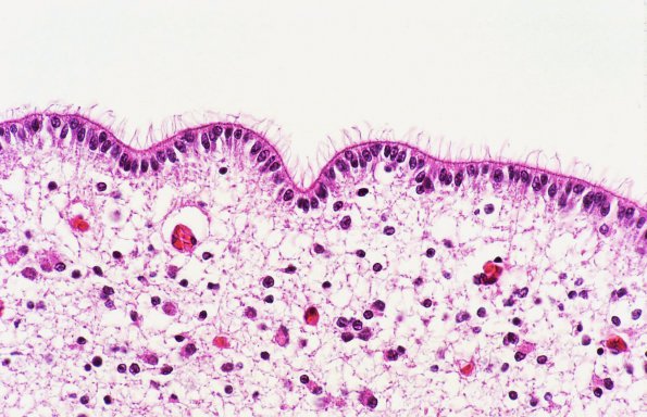 1A Ependyma, fetal