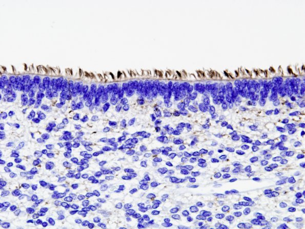 1C Ependyma, normal, neonate anti-acetylated tubulin 2A