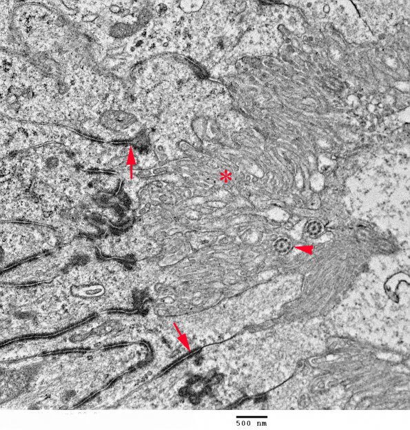 6A2 Central canal, mouse, 09-972B EM 064A copy - Copy