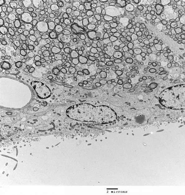 7A1 Ependyma, PANK 2 O (07-229F) 006 - Copy