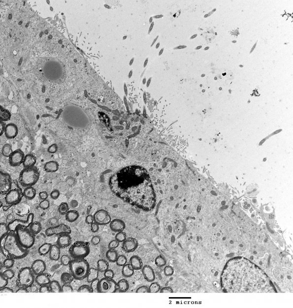 8A1 Ependyma, normal, rat (07-442 PLAgamma) EM 2 - Copy