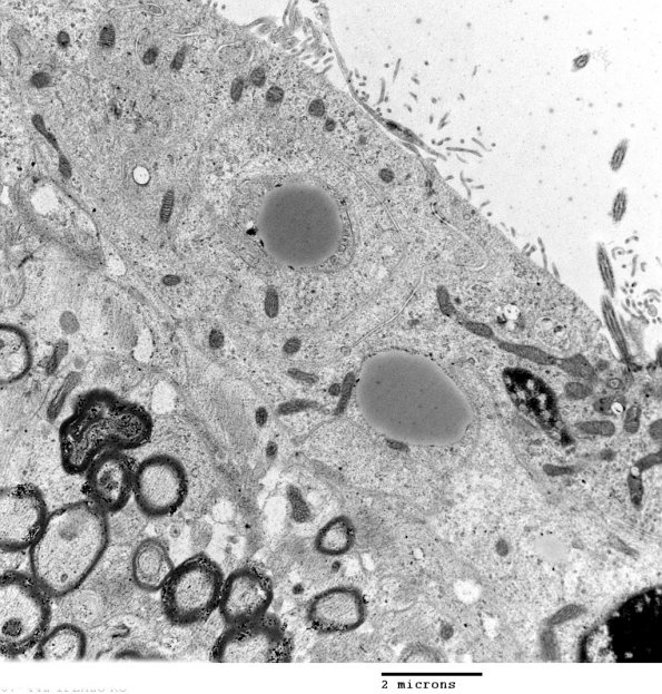 8A2 Ependyma, normal, rat (07-442 PLAgamma) EM 1 - Copy