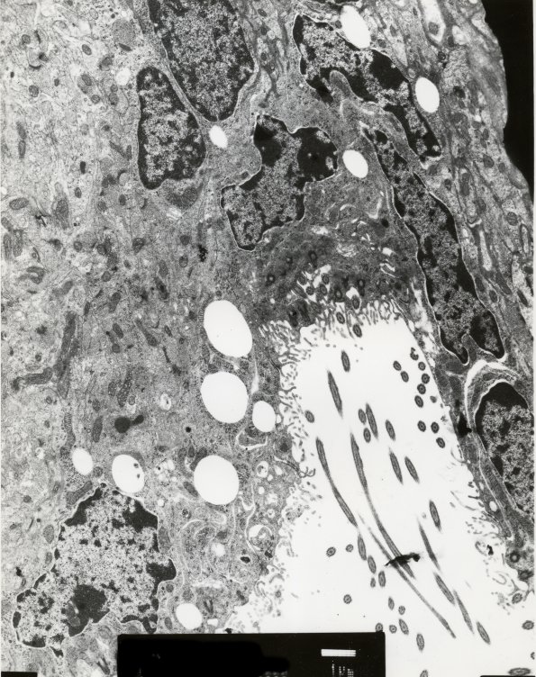 9A1 Ependyma AX8 weeks EM 1 - Copy