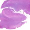 1A1 Hippocampus, normal (Case 1) H&E whole mount