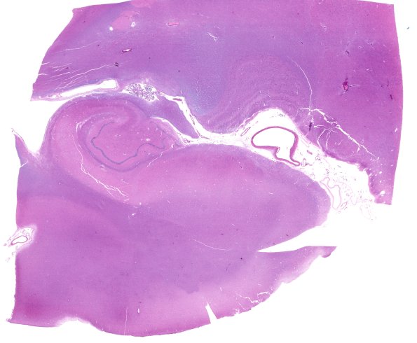 1A1 Hippocampus, normal (Case 1) H&E whole mount