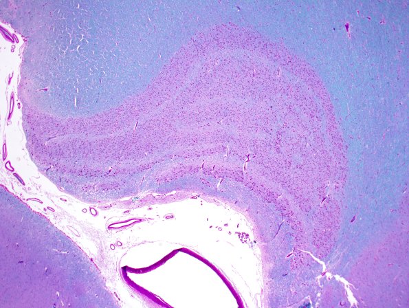 1B1-Hippocampus-normal-Case-1-LFB-PAS-2X.jpg