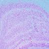 1B2 Hippocampus, normal (Case 1) LFB-PAS 4X