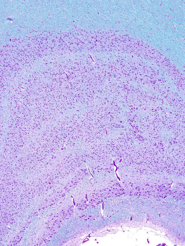 1B2 Hippocampus, normal (Case 1) LFB-PAS 4X