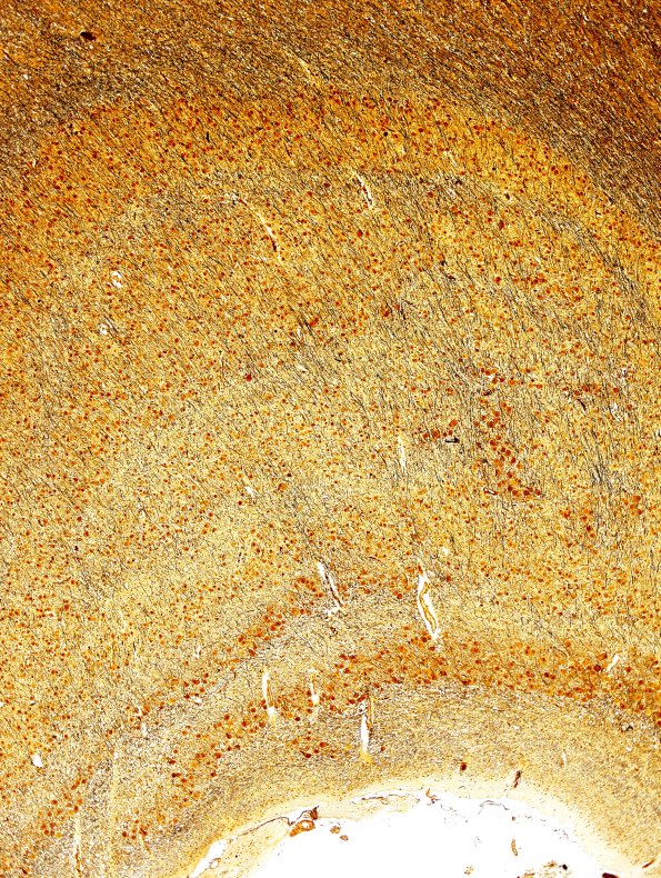 1C2 Hippocampus, normal (Case 1) Biels 4X