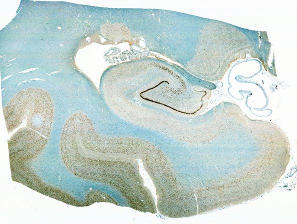 2A4 LGN, normal lamination (Case 2) NeuN 1