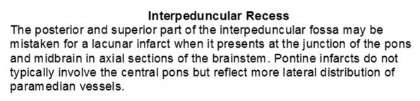 0A Interpeduncular recess - Text