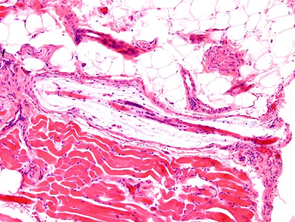 1A4A Muscle spindle (Case 4) H&E 3