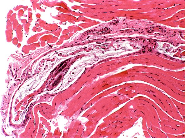 1A6A Normal Muscle, spindle H&E 1