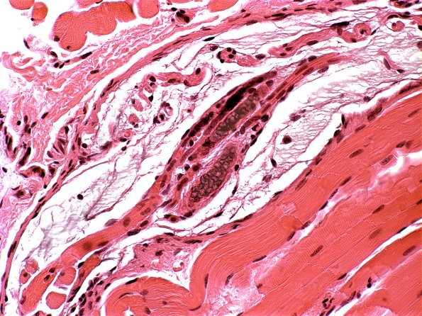 1A6B Normal Muscle, spindle H&E 2