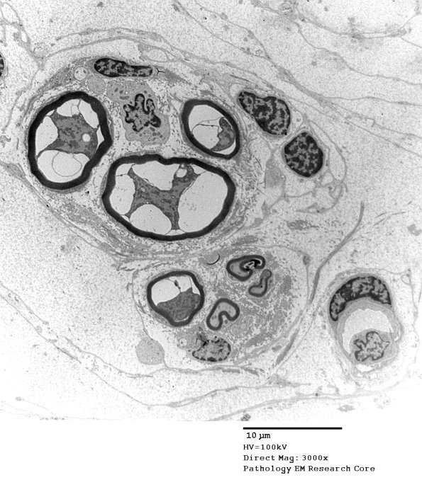 3A1B Muscle Spindle (Case 9) EM 015 - Copy