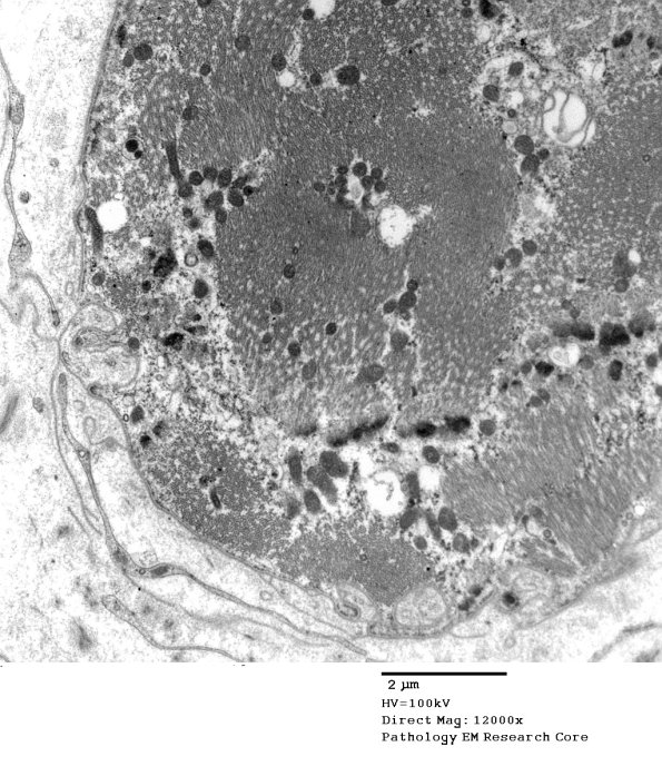 3A2C Muscle Spindle (Case 9) EM 033 - Copy