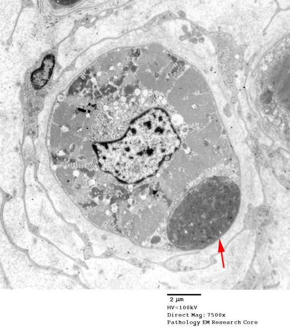 3B1A Muscle Spindle (Case 9) EM 022 copy - Copy