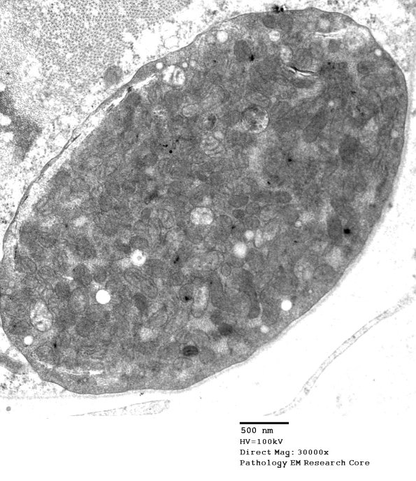 3B1C Muscle Spindle (Case 9) EM 028 - Copy