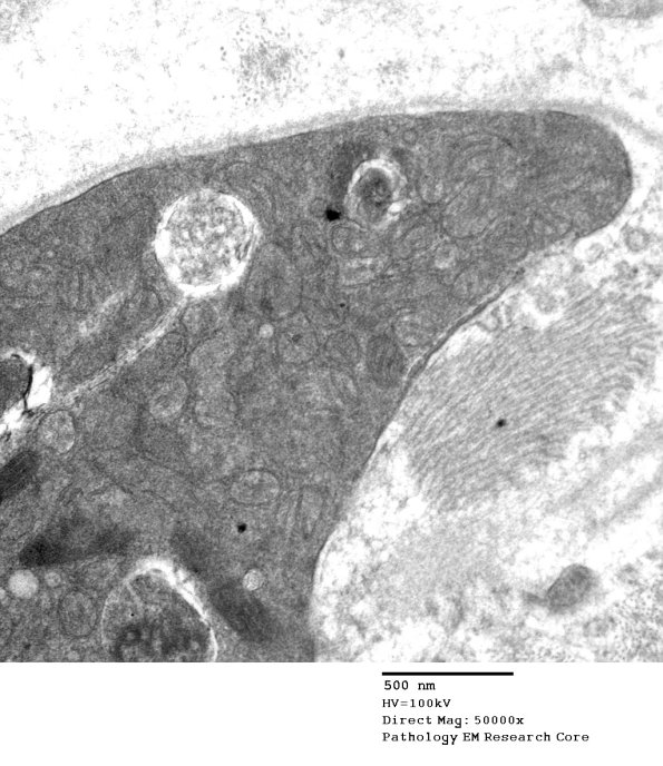 3C1C Muscle Spindle (Case 9) EM 036 - Copy