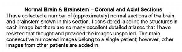 0A Normal Brain & Brainstem - Coronal & Axial Sections.pptx