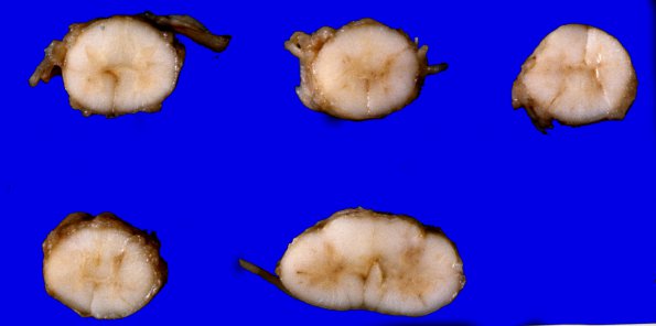 3 Spinal Cord, normal, Section 14