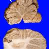 4A Cerebellum, normal - Hemisphere & Vermis Section 15 copy