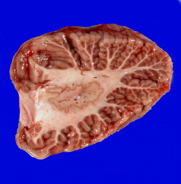 4B2 Cerebellum, normal (Case 4) dentate