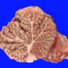 4C Normal Vermis Arbor Vitae (Case 4) gross 1