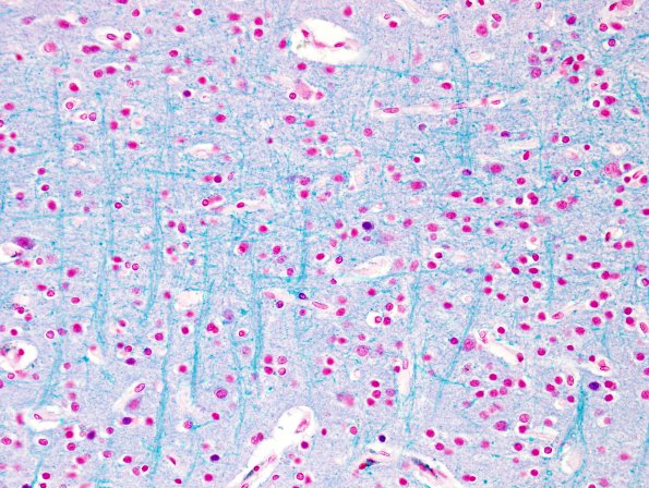 3A4 Occipital lobe, stria Gennari (Case 3) LFB-PAS 40X