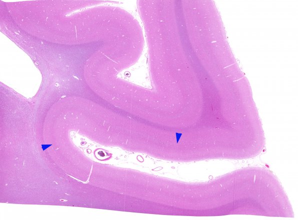 4A Striate Cortex (Case 4) H&E whole mount copy