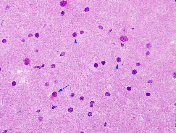 1A3 Oligodendrocyte without halo (frozen unfixed section, Case 1) H&E 6 copy