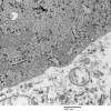 1E3 Neuron, satelliting oligos (Case 4) EM 032 - Copy