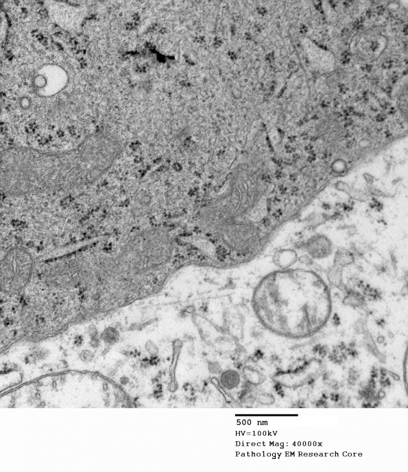 1E3 Neuron, satelliting oligos (Case 4) EM 032 - Copy