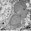 1F2 Oligodendroglia, satelliting (Case 5) EM 3 - Copy