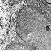 1F3 Oligodendroglia, satelliting (Case 5) EM 2 - Copy